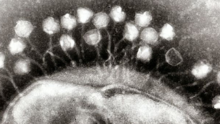 We Only Just Discovered This Super Common Virus That's Likely Inside You